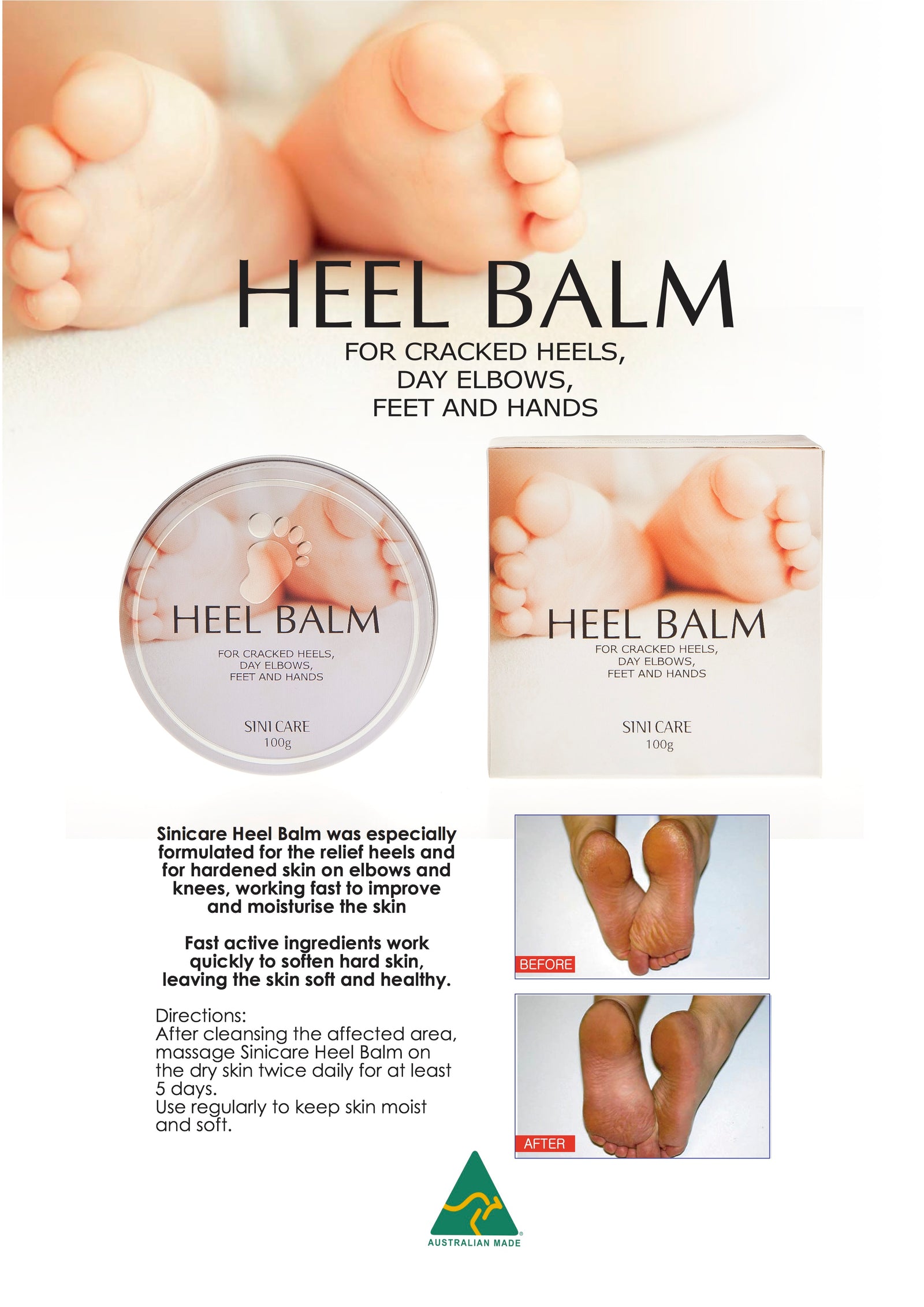 Heel Balm Soften Heels Heel Balm Soften Heels On Feet Urea Foot